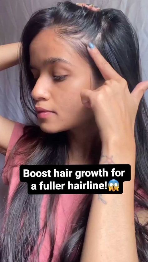 Boost Hair Growth For A Fuller Hairline! | Worried about a thinning hairline? Here's the best home remedy for growing back your hairline in weeks! | By Glamrs Hairline Growth, Grow Hair Overnight, Thinning Hairline, Growing Long Hair Faster, Regrow Hair Naturally, Grow Thicker Hair, Perfect Hair Color, Hair Care Growth, Hair Growing Tips