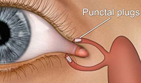 Eye Disorders, Eye Floaters, Increase Height Exercise, Dry Eye Symptoms, Sensory Nerves, How To Help Nausea, Eye Facts, Eye Anatomy, Eye Twitching