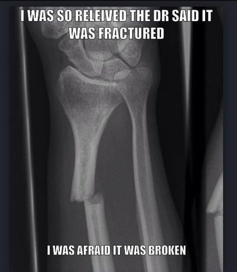 I seriously hear this all the time at work. Me "so you have a wrist fracture" patient "no, it's not just fractured, it's completely broken!"  ITS THE SAME THING!!! Radiography Humor, Medische Humor, Rad Tech Humor, Radiography Student, Xray Humor, Radiology Humor, Rad Tech Week, Radiologic Technologist, Dental Jokes