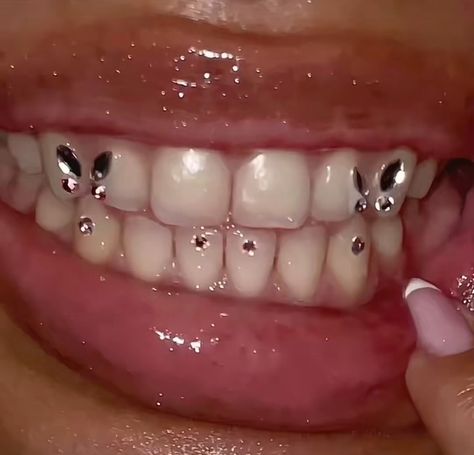 Butterfly Tooth Gems Ideas, Chandelier Tooth Gem, Tooth Gems Aesthetic, Diy Teeth, Teeth Gems, Pretty Teeth, Dental Jewelry, Grillz Teeth, Diamond Teeth