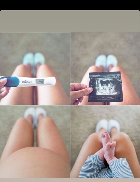 Vom Avea Un Copil, Announcement Pictures, Baby Bump Pictures, Pregnancy Belly Photos, Bump Pictures, Cute Pregnancy Pictures, Belly Photos, Idee Babyshower