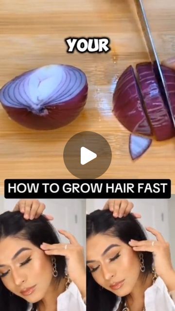 HealthTipssssss on Instagram: "HOW TO GROW HAIR FAST 
#hairgrowth #hairloss

#hairgrowthoil #naturalrecipe" How To Hair Growth Fast, Hairloss Diy Home Remedies, How To Grow Hair Fast, How To Grow Hair Faster, Natural Hair Remedies, How To Grow Hair, Longer Hair Faster, How To Grow Your Hair Faster, Home Remedies For Hair