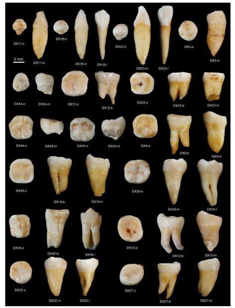 Teeth Aesthetic, Human Migration, Journal Nature, Dental Anatomy, Human Teeth, Loose Tooth, Fossil Teeth, Oil Pulling, Natural Teeth Whitening