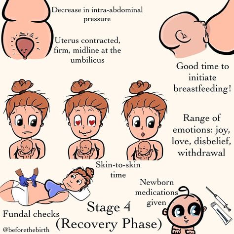 Christie | Childbirth Educator on Instagram: “Stage 4: Recovery Phase! The end of the stages of labor (and the beginning of a whole lot more!). This stage happens in the first 1 tot 4…” Doula Care, Relatable Mom, Body After Baby, Baby Hospital Bag, Stages Of Labor, Pregnancy Labor, Newborn Mom, Pregnancy Guide, Baby Life Hacks