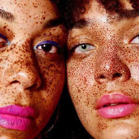 Photographers And Filmmakers Wanted: New Competition Hopes To Uplift Diverse Voices Women With Freckles, Treating Hyperpigmentation, Summer Skincare, Henna Tattoos, Medical Aesthetic, Confident Woman, Even Skin Tone, Skin Conditions, Beauty Trends