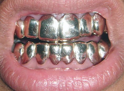 Golden Grill, Pretty Teeth, Gold Grill, Custom Grillz, Gold Grillz, Grills Teeth, Tooth Gem, Teeth Jewelry, Jewelry Fashion Trends