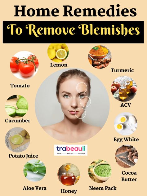 How To Get Rid Of Blemishes At Home [Home Remedies] - Trabeauli Forehead Acne, Potato Juice, Acne Overnight, Oily Skin Care Routine, Natural Acne Remedies, Blemish Remover, Baking Soda Uses, Skin Blemishes, Beauty Diy