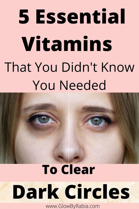 under eye dark circles Dark Circles Remedies, Eye Bag Remedies, Eye Health Remedies, Under Eye Dark Circles, Eye Dark Circles, Dark Circles Around Eyes, Eyes Dark Circles, Dark Circle Remedies, Moisturizing Eye Cream