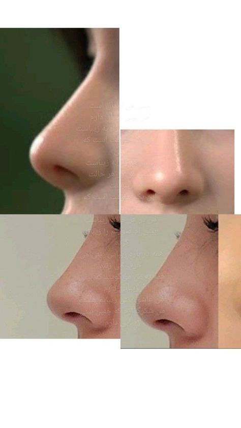 Desired Body Type, Round Button Nose, Nose Job Front Profile, Nose Manifestation, Ideal Face Subliminal, Nose Job Inspiration Natural, Front Profile Reference, Straight Nose Bridge, Ideal Nose