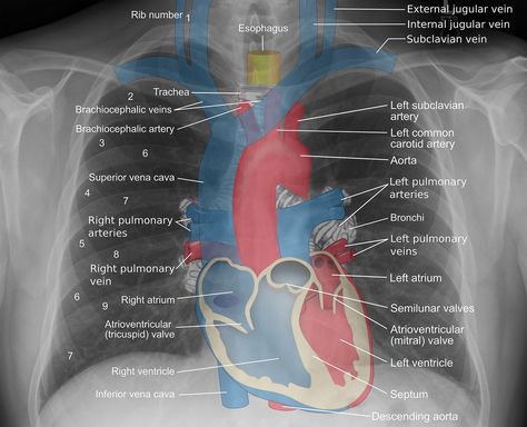 Deep Learning in HealthcareX-Ray Imaging (Part 2 Understanding X-Ray Images) Radiology Student, Radiology Imaging, Cardiac Nursing, Medical Student Study, Nursing School Survival, Critical Care Nursing, Respiratory Therapy, Medical School Studying, Human Anatomy And Physiology