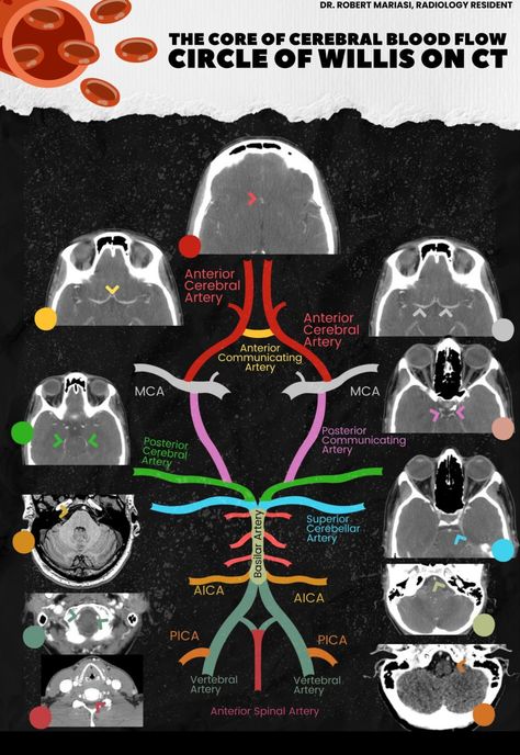 Cath Lab Nursing, Nursing School Studying Cheat Sheets, Med Notes, Medical Radiography, Radiology Student, Radiology Imaging, Medical School Life, Medicine Notes, Radiology Technologist