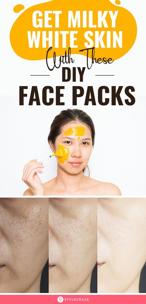 Get Milky White Skin With These DIY Face Packs: If you follow a disciplined skincare routine which includes regular use of the home remedies laid out here, you will be the owner of a pure peaches and cream complexion in no time! Read on to know more about these remedies. #Skincare #SkincareTips #DIY #FaceMasks #FacePacks Skin Lightening Diy, Proper Skin Care, Beauty Tips For Glowing Skin, Peaches And Cream, Skin Remedies, Utila, White Skin, Beauty Skin Care Routine, Milky White