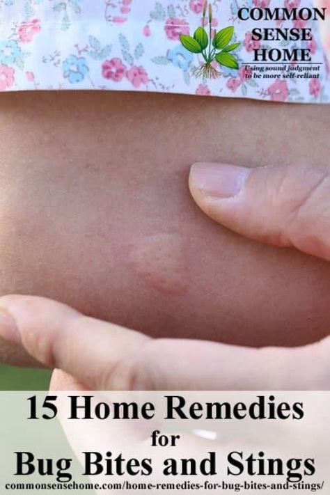 15 Home Remedies for Bug Bites and Stings - Ditch the itch from mosquito bites and more with these easy to use bite treatments. Natural Bug Bite Remedy, Remedies For Bug Bites, Bug Bite Itch, Remedies For Bee Stings, Remedies For Mosquito Bites, Bug Bites Remedies, Bug Bite Relief, Bite Relief, Bed Bug Bites