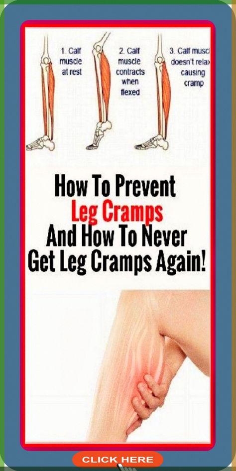 How To Prevent And Stop Painful Leg And Calf Cramp That Begin When You’re In Bed – Koperacija What causes leg and calf cramps at night?Only imagine that you are lying down and your lower leg seizes.... Leg Cramps Causes, Nighttime Leg Cramps, Leg Cramps At Night, Gastrocnemius Muscle, Calf Cramps, Home Medicine, Restless Leg Syndrome, Leg Cramps, Preventative Health