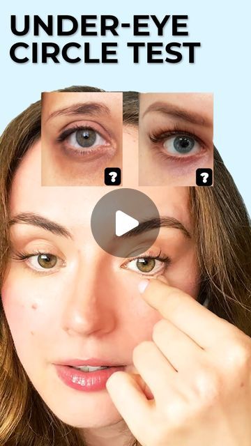 Anastasia Goron on Instagram: "🌟✨ **Determine Under-Eye Discoloration Causes** ✨🌟  To understand whether under-eye discoloration is due to a #bloodcirculation issue or skin #discoloration, use this simple test:   Gently pinch and hold the skin under your eyes. If the discoloration lightens, it’s likely related to poor blood circulation. If it remains, it may be due to pigmentation or other skin issues. This method helps you tailor your approach to #skincare and treatments effectively. 🌿💆‍♀️ #UnderEyeCare #HealthySkin #AllYouCanFace" Carpet Smell, Dark Spots On Face, Facial Yoga, Cleansing Pads, Spots On Face, Lighter Skin, Undereye Circles, Skin Discoloration, Glow Up Tips