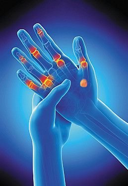 Identifying arthritis in your fingers and thumbs - Harvard Health 2 Joints Hand Sign, Hand Pain, Nerve Pain, Cold Therapy, Get A Tattoo, Hand Tattoos, How To Draw Hands, I Hope, Health