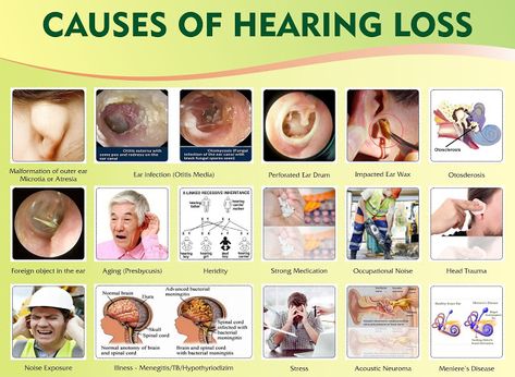 Hearing aid: WHAT ARE THE SYMPTOMS OF HEARING LOSS? Hearing Loss Awareness, Audiologist Office, Impacted Ear Wax, Ear Pressure, Speech And Hearing, Language Delay, Clinic Interior, Teacher Board, Hearing Health