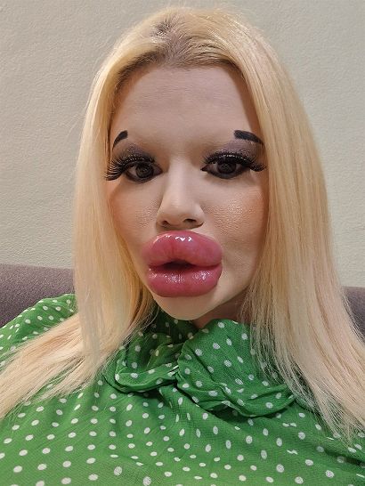 'Natural beauty is boring to me so I decided to change my appearance,' says Andrea who opened up about the struggle to find love. Change My Appearance, Bulgarian Women, Botox Lips, Large Lips, Fake Lips, Celebrity Plastic Surgery, Body Modification, Just She, Cosmetic Procedures