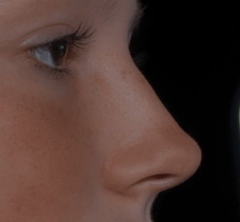 Dream Nose, Greek Nose, Upturned Nose, Hooked Nose, Rhinoplasty Nose Jobs, Job Inspiration, Straight Nose, Pretty Nose, Perfect Nose