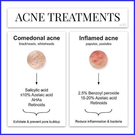 Comedonal Acne, Back Acne Treatment, Make Up Foundation, Back Acne, Acne Treatments, Types Of Acne, Skin Cleanser Products, Skin Care Treatments, Beauty Skin Care Routine