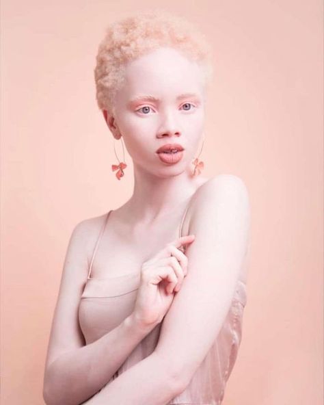 Greatness In Albinism: Nitisinone Increases Melanin In People With Albini... Photo Manga, Face Drawing Reference, Photographie Portrait Inspiration, Human Reference, Body Reference Poses, Vogue Covers, Human Poses Reference, Arte Inspo, Poses References