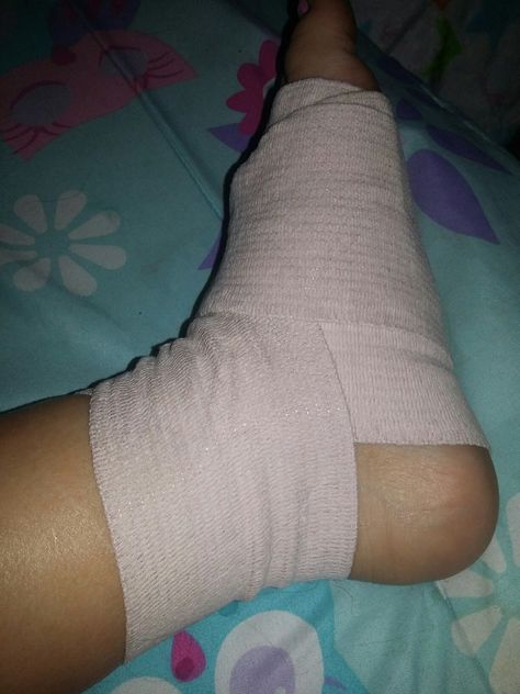 My foot😢😢😢😢😢😢 Ankle Injury Prank, Leg Accident Real Pic For Women, Leg Bandage Snap, Fake Injury Leg Snapchat, Leg Injury In The Hospital, Leg Injured Images, Leg Swelling Snapchat, Leg Fracture Snapchat Story, Knee Injury Pics