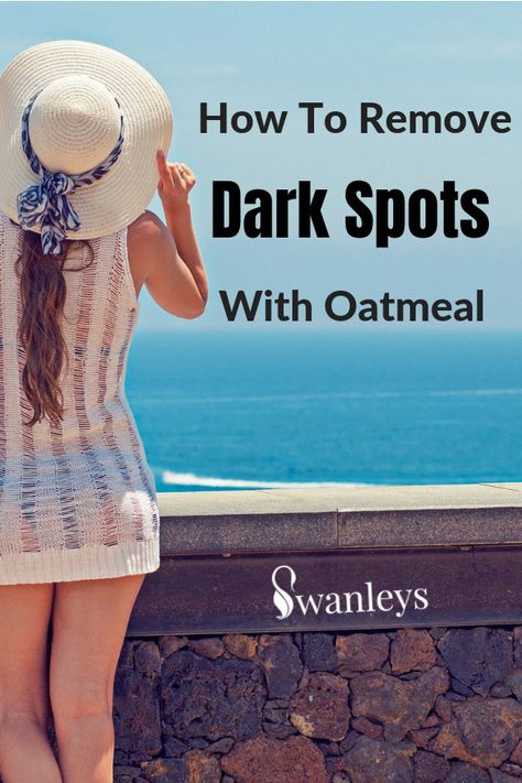 Ways to get Rid Of Brown Spots on Confront #BrownSpotsBetweenTeeth #BrownSpotsOnSkin #DarkBrownSpotsOnFace Oatmeal For Skin, Sun Spots On Skin, Spots On Forehead, Brown Spots On Hands, Brown Age Spots, Brown Spots On Skin, Spots On Legs, Brown Spots Removal, Brown Spots On Face