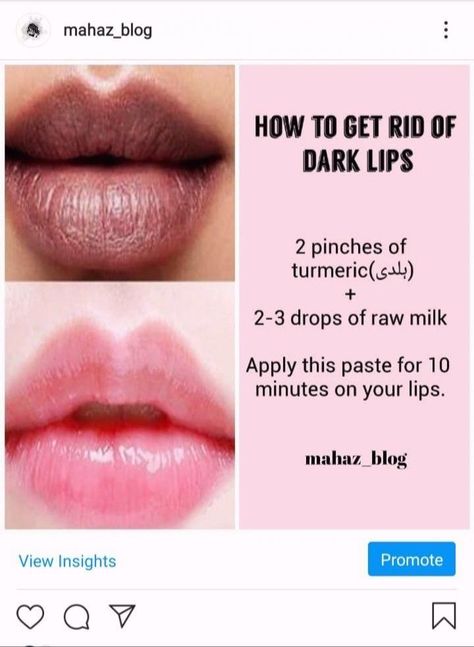 Lip Mask For Dark Lips, Tips For Dark Lips, How To Lighten Dark Lips Naturally, Lip Mask Homemade For Dark Lips, Lip Care For Dark Lips, Dark Lips Remedy Homemade, How To Lighten Lips, How To Lighten Dark Lips, Lip Pigmentation Remedy