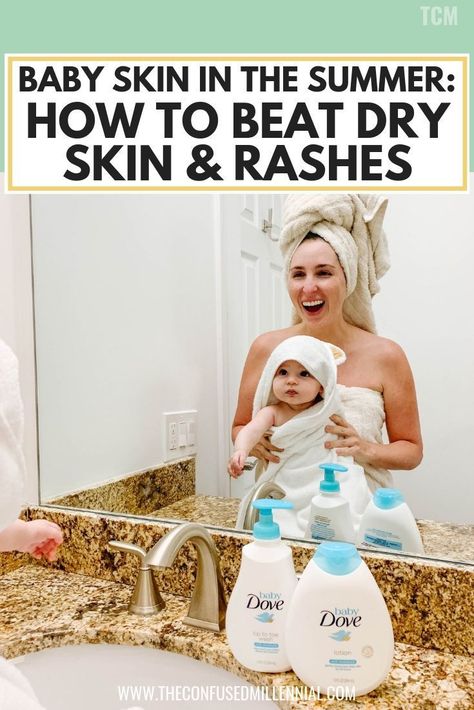 Baby Skin In The Summer: How To Beat Rashes & Dry Skin with Dove, newborns baby skin problems like peeling or bumps on the face or behind the knees, tips and remedies for baby acne, daily baby skincare routine from a new mom having problems, #babyskin, #motherhood, #newbornskin Baby Skin Care Tips, Toddler Home Activities, Baby Beat, Baby Acne, Baby Sunscreen, Heat Rash, Baby Shoot, Sweat Gland, Parenting 101