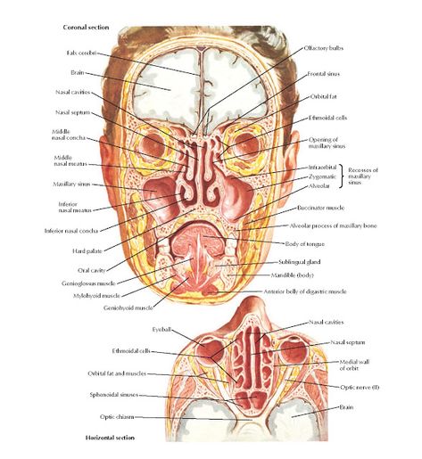 Paranasal Sinuses Anatomy   Coronal section, Horizontal section, Brain, Falx cerebri, Nasal cavities, Nasal septum, Maxillary sinus, Infe... Sinuses Anatomy, Anatomy Head, Paranasal Sinuses, Maxillary Sinus, Sinus Cavities, Brain Surgeon, Free Drawing, Nasal Cavity, Brain Anatomy