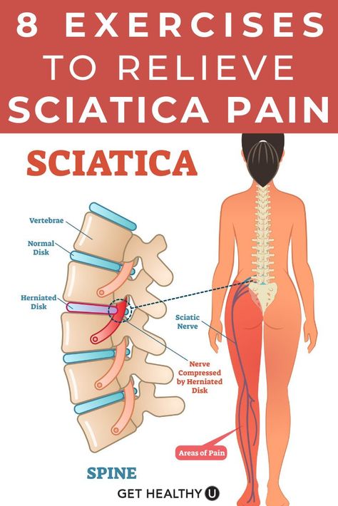 Sciatica is pain, tingling or numbness that comes from the irritation of the sciatic nerve or the nerve roots that lead to the sciatic nerve. The discomfort can be felt in the buttocks on one side, down the side or back of the leg, or even in the ankle and foot. To help keep your sciatic nerve pain at bay, perform these 8 Sciatica stretches a few times a week to help relieve your pain and get you feeling great again. Sciatic Nerve Exercises, Nerve Relief, Sciatic Nerve Relief, Sciatic Nerve Pain Relief, Yoga For Sciatica, Sciatica Stretches, Back Pain Stretches, Sciatica Exercises, Sciatica Pain Relief