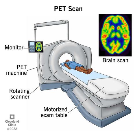 PET Scan: What It Is, Types, Purpose, Procedure & Results Pet Scan Image, Ct Scan Aesthetic, Brain Issues, Psychology A Level, Brain Disorders, Pet Ct, Pet Scan, High Contrast Images, Brain Scan