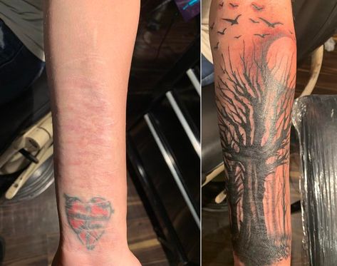 Tattoos For Scars, Tattoo Coverup, Scar Cover Up, Forever Tattoo, Scar Tattoo, R Tattoo, Tattoo Cover-up, Cover Up Tattoo, Professional Tattoo