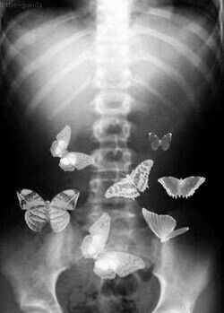 You Give Me Butterflies, Butterflies In My Stomach, Give Me Butterflies, Trik Fotografi, X Ray, Make Me Smile, True Love, Butterflies, Funny Memes