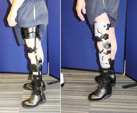 Cumbersome NHS leg calliper vs. lightweight carbon fibre knee brace from Technology in Motion Aesthetic Mobility Aid, Walking Cast, Orthotics And Prosthetics, Braces Girls, Swan Painting, Health Goth, Goth Subculture, Prosthetic Leg, Leg Braces