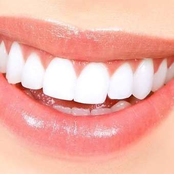 Snap On Smile, Teeth Covers, Veneers Teeth, Coconut Oil For Teeth, False Teeth, Loose Tooth, Nice Teeth, Dental Veneers, Teeth Health