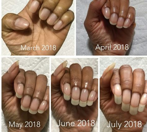 Long Nails Growth, How To Get Your Nails Long And Strong, Real Nail Designs, How To Grow Strong Long Nails, Real Nails Manicure, Real Long Nails, Tips For Long Healthy Nails, How Yo Grow Your Nails Fast In A Week, Ugly Outfit