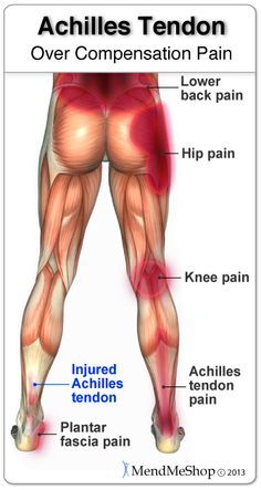 Achilles Bursitis, Pulled Hamstring, Injured Leg, Achilles Pain, Hamstring Muscles, Achilles Tendon, Hip Pain, Heel Pain, Hip Flexor