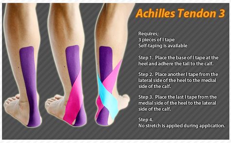 Kinesiology taping instructions for the achilles tendon #ktape #ares #achillestendon Achilles Pain, K Tape, Shoe Tips, Achilles Tendon, Kinesio Taping, Running Injuries, Sports Tape, Kinesiology Taping, Shin Splints