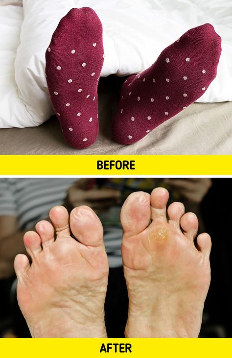 Some people can’t fall asleep if they don’t have their warm socks on, and others can’t bear the thought of sweating at night and go to bed barefoot. But as it turns out, sleeping with your socks on can have some less-than-pleasant consequences, and if you’re used to leaving your socks on overnight, you may want to reconsider this habit. The Bright Side team decided to find out what happens if you wear your favorite socks all night long. Heavy Blanket, When You Leave, Gloomy Day, Warm Socks, Bright Side, Fall Asleep, How To Run Longer, How To Fall Asleep, Funny Design