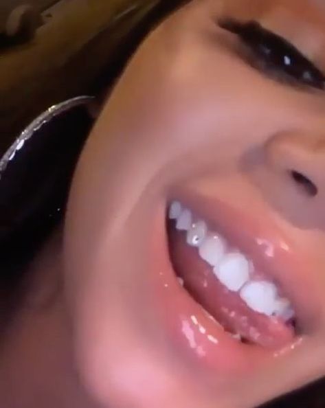 Tooth Gems Aesthetic Simple, Tooth Gems Simple, Tooth Gems Aesthetic, Girl Grillz, Teeth Gems, Dental Jewelry, Grillz Teeth, Diamond Teeth, Tooth Gems