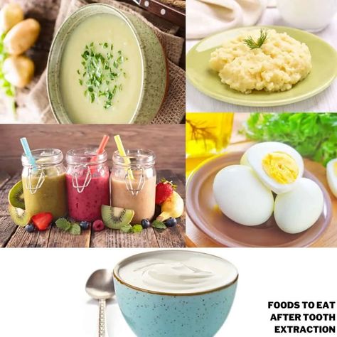 Meals To Eat After Wisdom Teeth Removal, Good To Eat After Wisdom Teeth, Soft Foods After Tooth Extraction, What To Eat After Tooth Extraction, Foods To Eat After Tooth Extraction, Tooth Extraction Aftercare Food, Soft Foods After Surgery Teeth, Wisdom Teeth Removal Food, Blended Soups