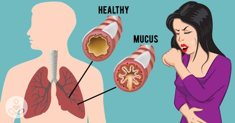 Do you ever find yourself congested with a phlegmy cough at night? Or feel sharp pains in your chest when you are lying down? Do you want to get rid of this feeling and have healthy lungs again? There are many natural chest congestion remedies out there, but this one is designed specifically to clear your lungs... View Article Phlegm In Throat, Getting Rid Of Mucus, Chest Congestion Remedies, Congestion Remedies, Getting Rid Of Phlegm, Persistent Cough, Healthy Lungs, Congestion Relief, Chest Congestion