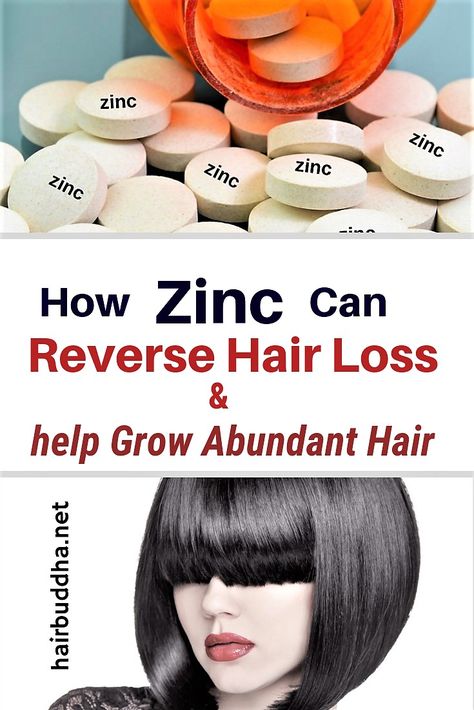 Hair Buddha, Biotin Benefits, Growth Of Hair, Thick Hair Remedies, Female Pattern Baldness, Zinc Deficiency, Male Pattern Baldness, Pattern Baldness, Regrow Hair