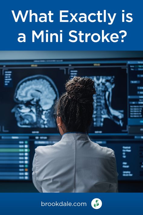 Mini Strokes Signs, Mini Strokes Symptoms, Nursing Apps, Medical Things, Types Of Strokes, Brain Injuries, Migraine Headache, Preventative Health, Warning Sign