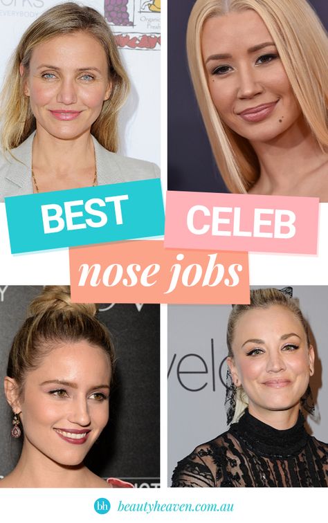 Natural nose jobs: The best celebrity nose jobs Beyonce Nose Job, Blake Lively Nose, Natural Nose Job, Celebrity Nose Jobs, Bad Nose Jobs, Natural Nose, Nose Jobs, Jamie Lynn, Tyra Banks