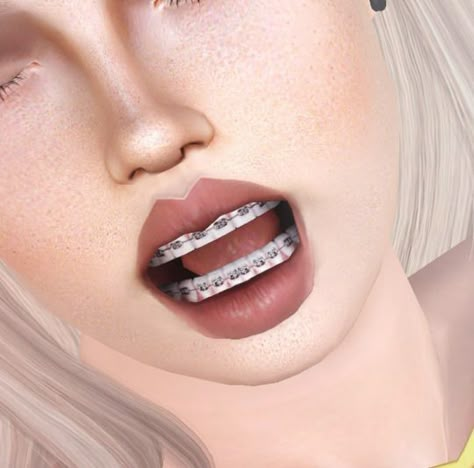 DescargasSims The Sims 4 Cc Braces, Braces Cc Sims 4, Sims 4 Teeth Cc Braces, Sims 4 Male Piercings, Sims 4 Accessories Cc Piercings, Sims 4 Cc Braces Teeth, Sims 4 Cc Clothes Teen Girl, Sims 4 Cc Lip Piercing, The Sims 4 Piercing Cc