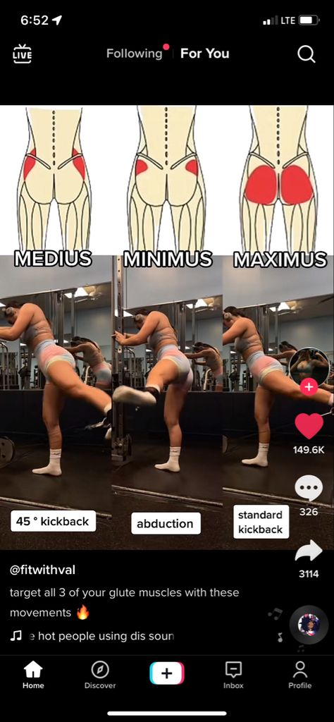 Workouts For Glute Medius, Glutes Anatomy Muscle, Workout For Gluteus Medius, Gluteus Muscles Anatomy, Workout Upper Glutes, Gluteus Exercises Gym, Parts Of The Glute Muscles, Glute Med Kickback, Gluteos Medius Exercise