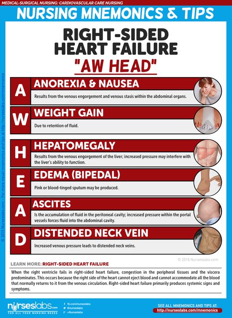 Nursing Mnemonics, Surgical Nursing, Medical Surgical Nursing, Cardiac Nursing, Nursing School Survival, Nursing School Studying, Nursing School Tips, Nursing School Notes, Nursing Tips