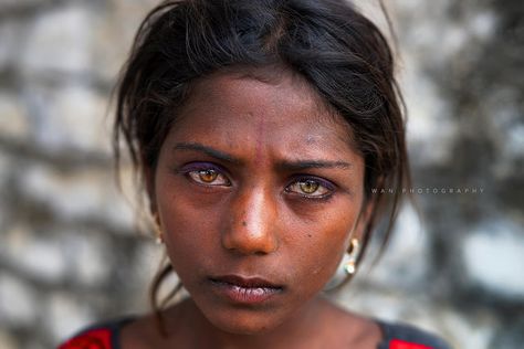 The Gypsy Girl with two different eye colors | by Thanwan Singh Two Different Eye Colors, Different Eye Colors, Heterochromia Eyes, Bald Women, Unique Faces, Magic Eyes, Aesthetic People, We Are The World, Gorgeous Eyes